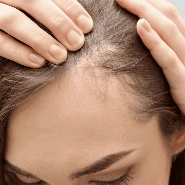 Alopecia & Hair Loss
